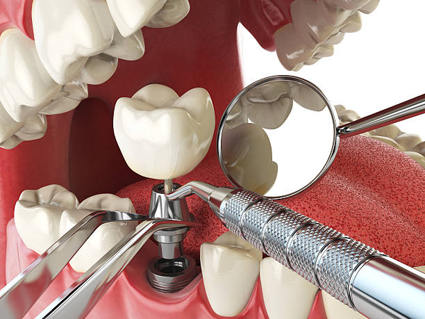 Best Broken or Chipped Tooth Repair in Waupaca, WI